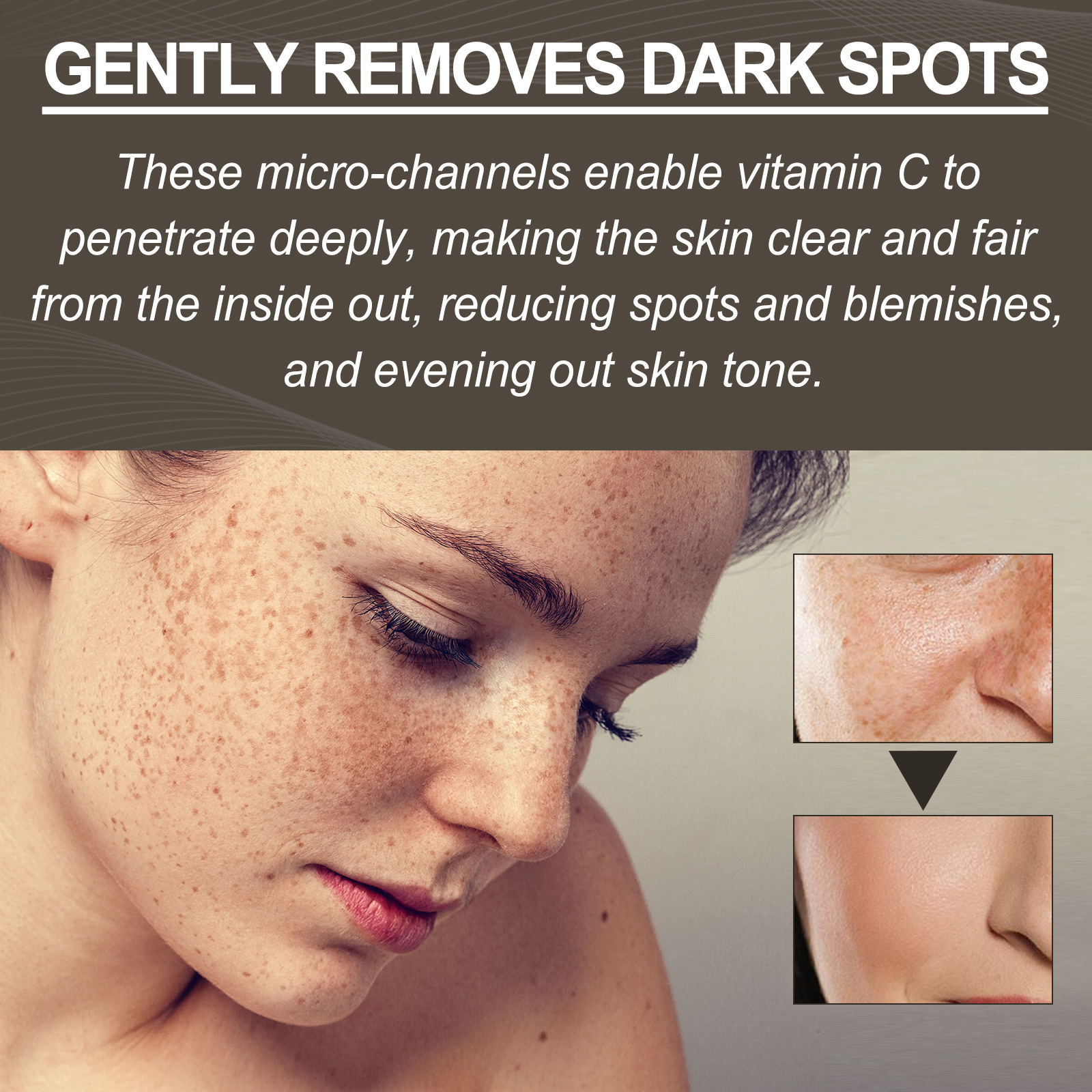 Plasture anti-iritații West&Month pentru a atenua roșeața, petele acneice, defectele gurii închise, acoperirea petelor, plasturi reparatori_voghion.com