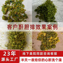 美容院肝胆套盒台湾清复合果蔬酵素粉谷物肠嗨吃调理饮品原液净化