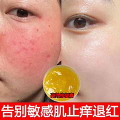 万能修復クリーム、赤みを消す、敏感肌、赤み軽減、キューティクル修復、ホルモン性皮膚炎修復クリーム、高効率修復クリーム