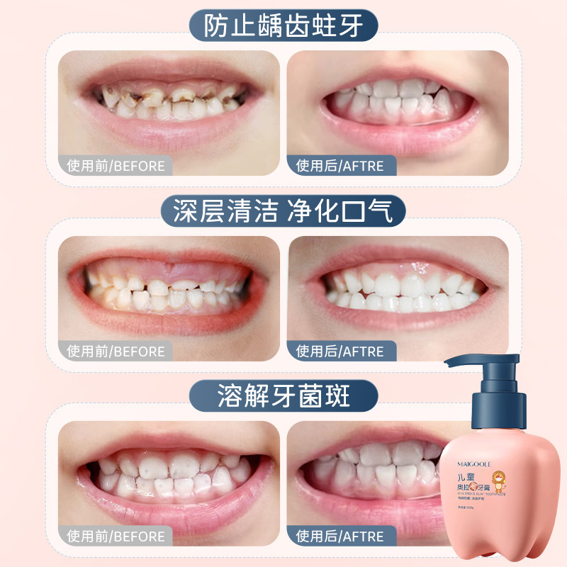 Douyin の人気の Rose Madeline 子供用 Ora フッ素歯磨き粉ディープクレンジング防虫固形歯ベビー特別な低フッ素歯磨き粉|undefined