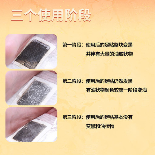 Old Beijing Foot Patch Nanjing Tong Ren Tang [Hot Selling] A box of 50 patches to remove moisture, mugwort and old ginger foot moxibustion patches