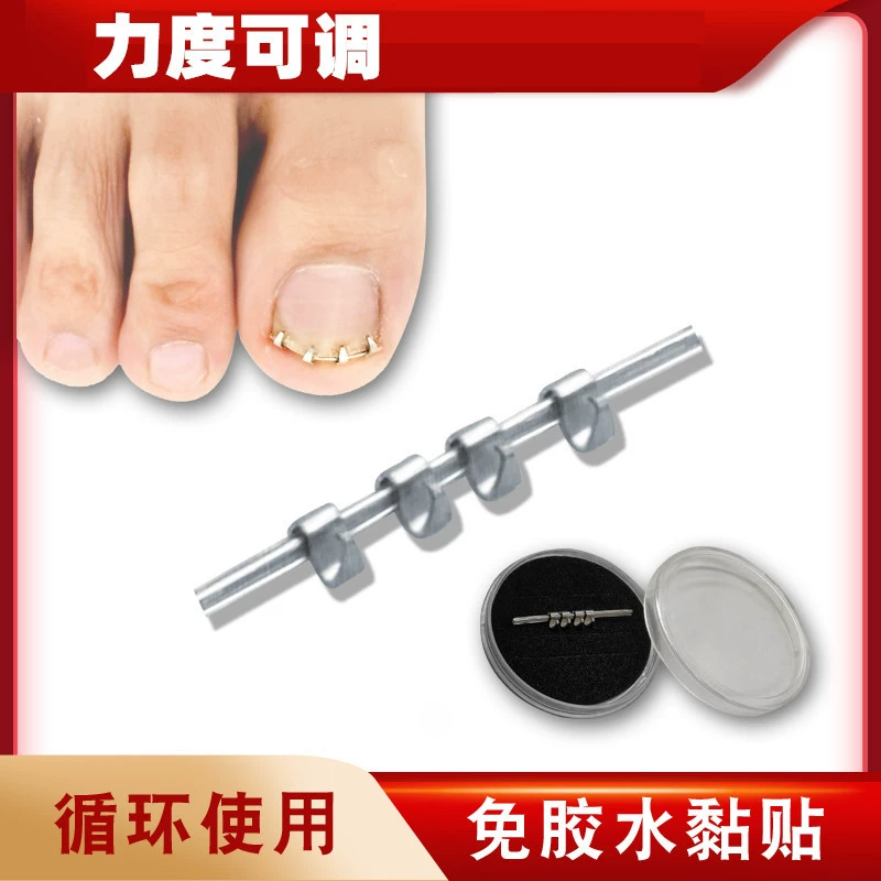 Физическое растяжение пластырей