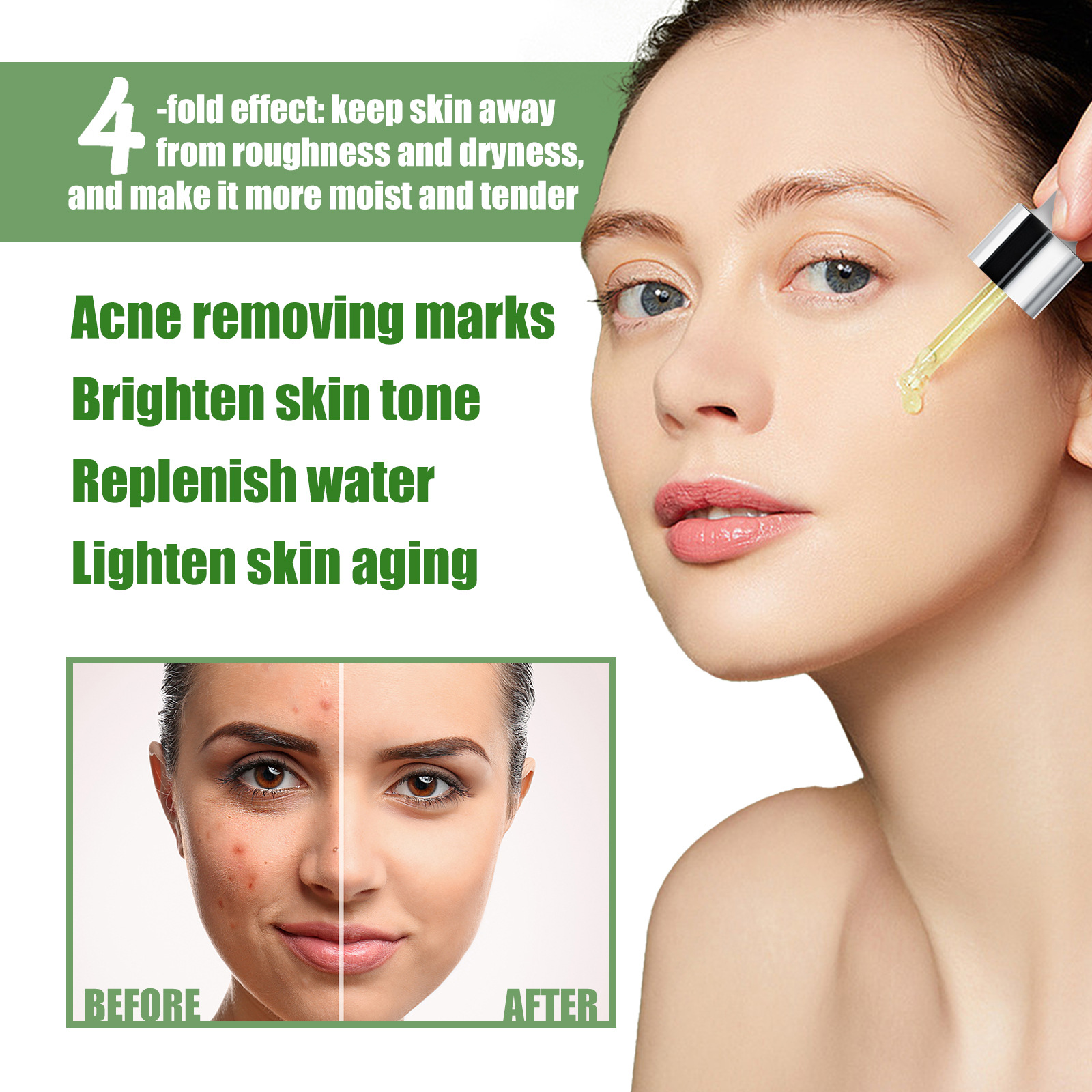 Esence s olivovým olejem West&Month pro odstranění akné se zavřenými ústy, zesvětlení skvrn po akné a opravu tmavé pleti_voghion.com