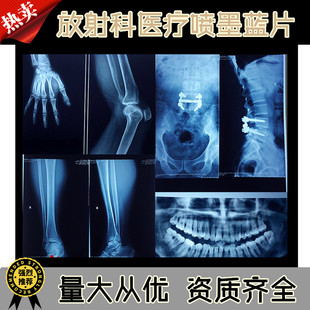 �t�Ç�ī�{ɫ�zƬ�{����ʽ����ƴ�ӡ�zƬ���ƹ���X��Ƭ DR CR CT