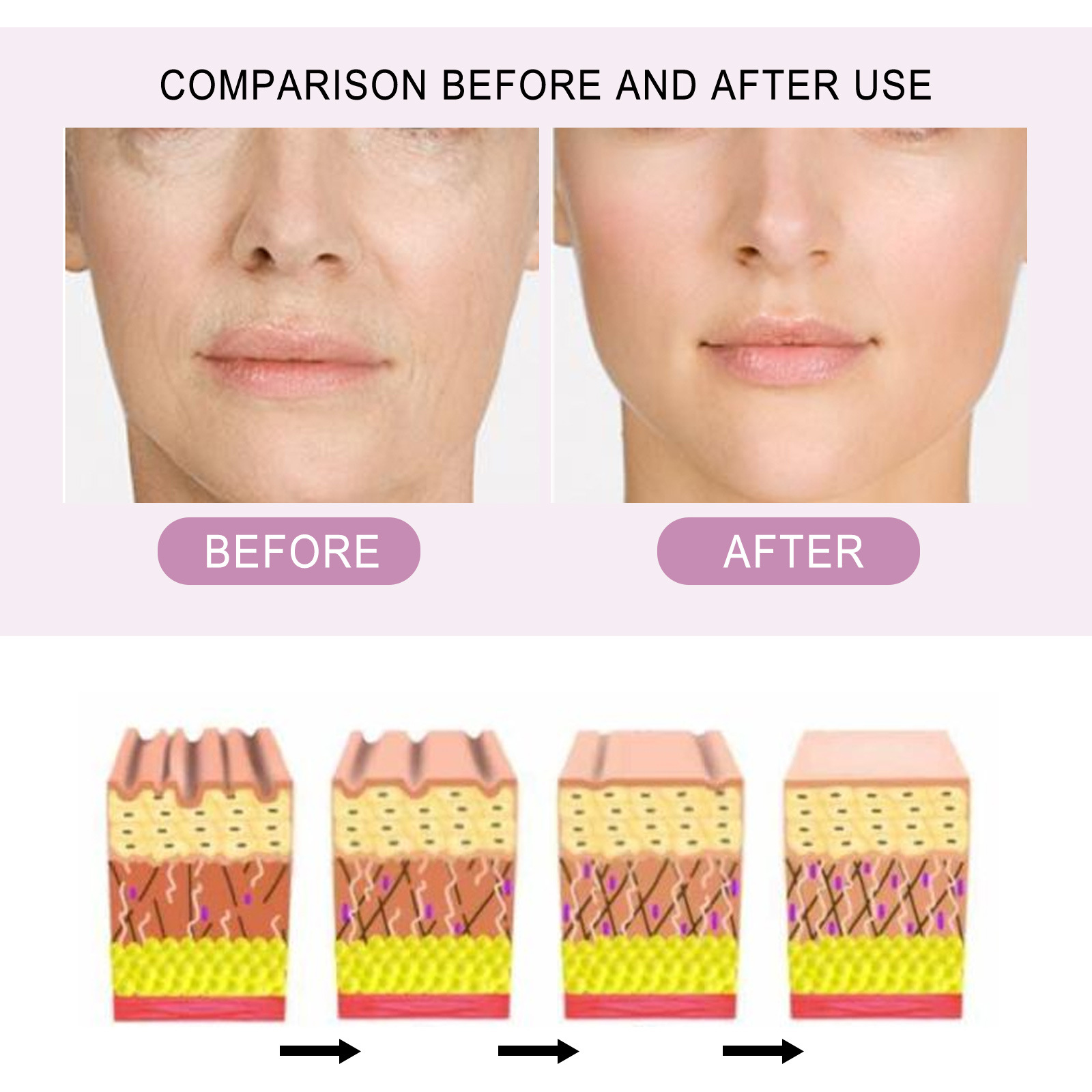 L'essenza pre-fiala di ceramide EELHOE indebolisce le linee sottili, ricostituisce l'acqua e il collagene può migliorare l'antirughe della pelle_voghion.com