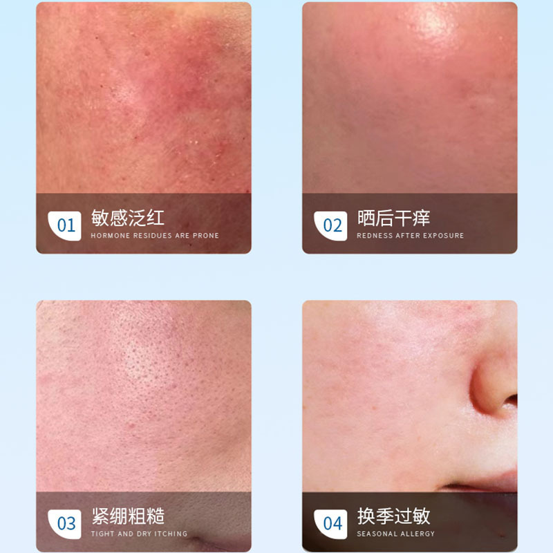 高級韓国式エステB5エッセンスウォーターが肌バリアを修復し、敏感肌を落ち着かせ、潤いを与え、SPAレベルのケアを提供します。|undefined