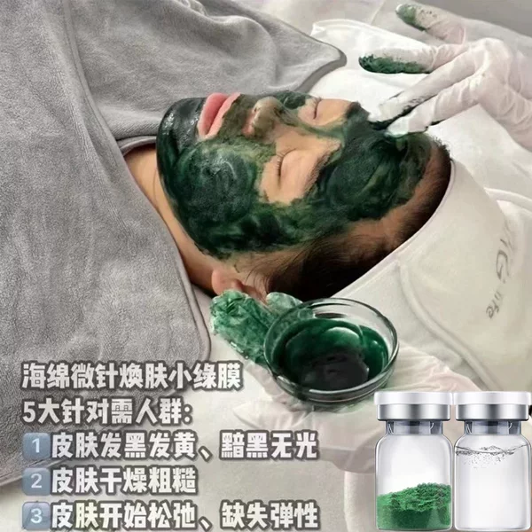 70% Long Needle Sponge Micro-Needle Removes Acne, Fades Acne Marks, Clears Closed Acne, Small Green Film Bone Needle Rejuvenates Skin Set, Beauty Salon