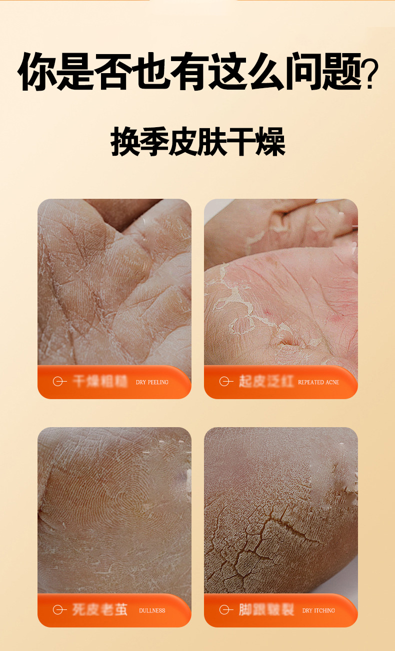 Horse Oil Cracked Skin Balm Herbal Hand Cream for Dry Chapped Hands 30g overview