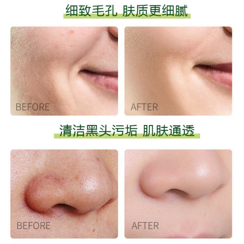 Mengxi Blue Wild Vegetable Rejuvenating Essence Cleansing Cream Facial Mild Exfoliating Massage Cream Moisturizing Oil Control Cleansing Cream