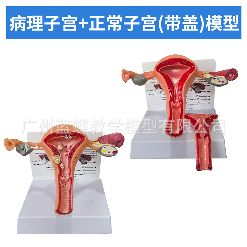 Ů����ֳģ��ģ��Ů����ֳģ��ģ��˽���ӹ�ģ�ͽ̾߸����ѳ�����