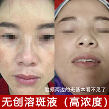 oܰҺÓƤAҺԺȥȸߕSְƤҺ