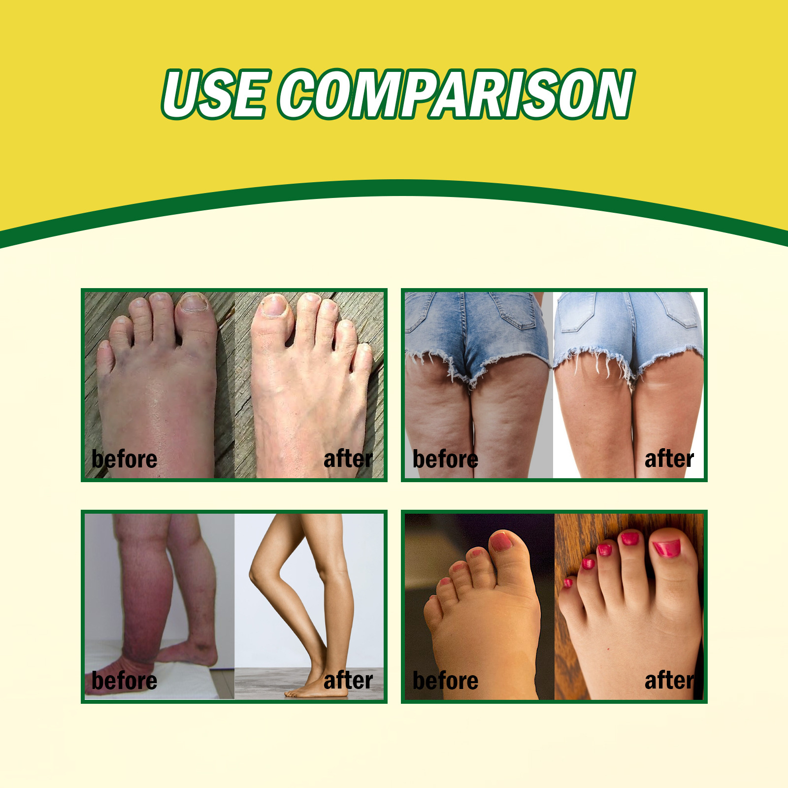 South Moon Ginger Cream Soothing Leg Pain Swelling, Moisture wicking, Cold dispelling, and Body Shaping_voghion.com