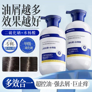 Selenium disulfide shampoo, emulsion, oil control, anti-itch, fluffy, anti-dandruff shampoo, salicylic acid, fragrant, smooth, family-friendly