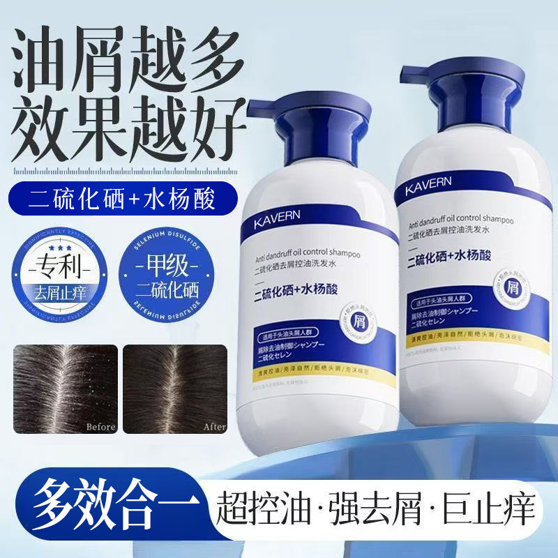 Selenium Disulfide Shampoo, Oil Control, Anti-Itch, Fluffy, Anti-Dandruff Shampoo, Salicylic Acid Fragrance, Smooth, Family General Purpose
