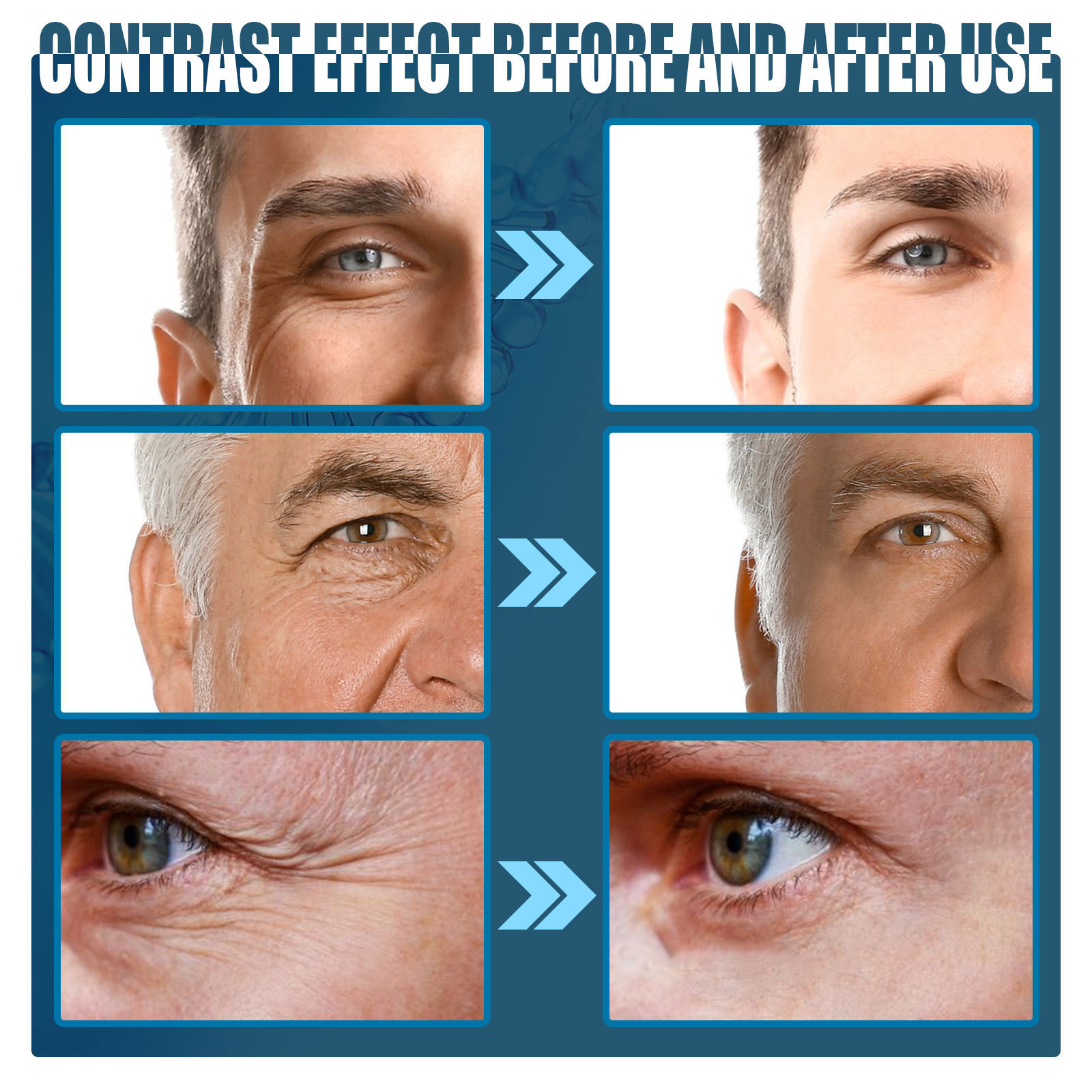 Anti-Aging-Augencreme für Männer, reduziert Falten und Augenringe, spendet Feuchtigkeit und festigt die Augenpartie_voghion.com