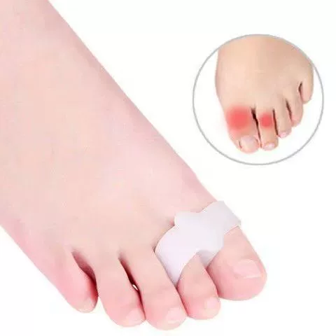 Силиконовый вальгусный корректор с двойным кольцом для большого пальца стопы, корректор большого пальца стопы, устройство для разделения пальцев ног, носить обувь днем и ночью