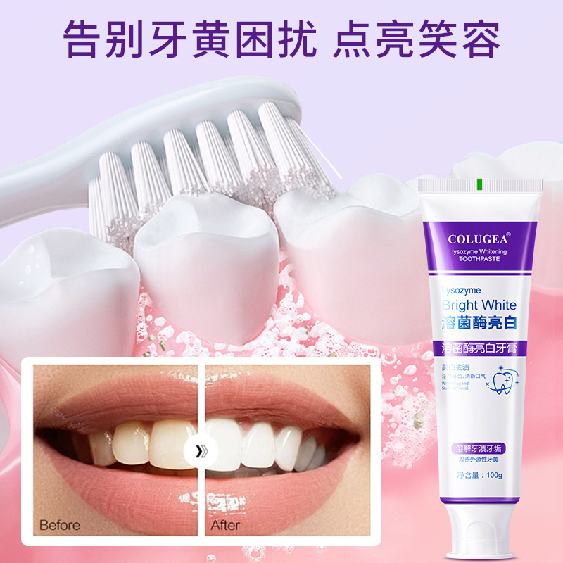 ホット商品 リゾチーム ホワイトニング 歯の黄ばみ ホワイトニング歯磨き粉 フレッシュブレス クレンジング ステイン除去 カラー修復 フッ素配合 メーカー発送|undefined