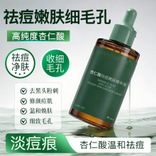 ���ݻ�����������w���AҺ����͹���ȥ�]�ڷ۴̺��^ԭҺ���l