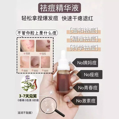 にきびの精華液はにきびの印のにきびを取り除きます。