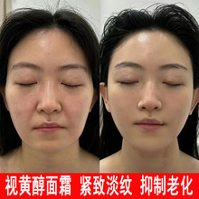 视黄醇面霜抗初老去皱补水保湿晚霜修护紧致抗皱嫩肤霜维a醇面霜