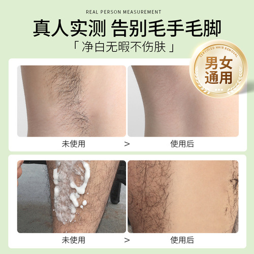 Women's Hair Removal Cream for Underarms, Pubic Area, and Leg Hair—A Specialized Mousse Formula for Full-Body, Non-Permanent Root Removal