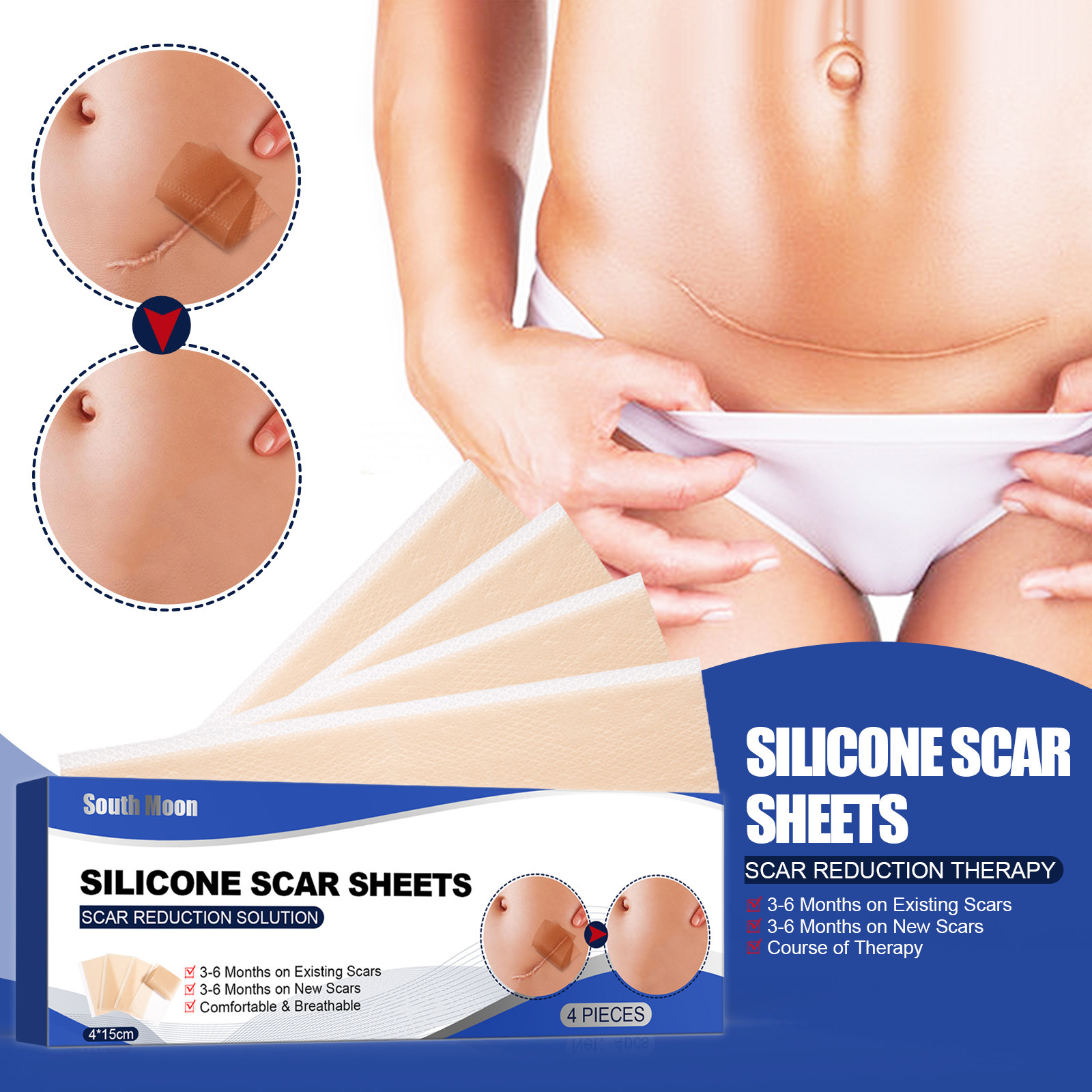 South Moon self-adhesive silicone scar patch repair burn scars smooth skin skin wound care patch_voghion.com
