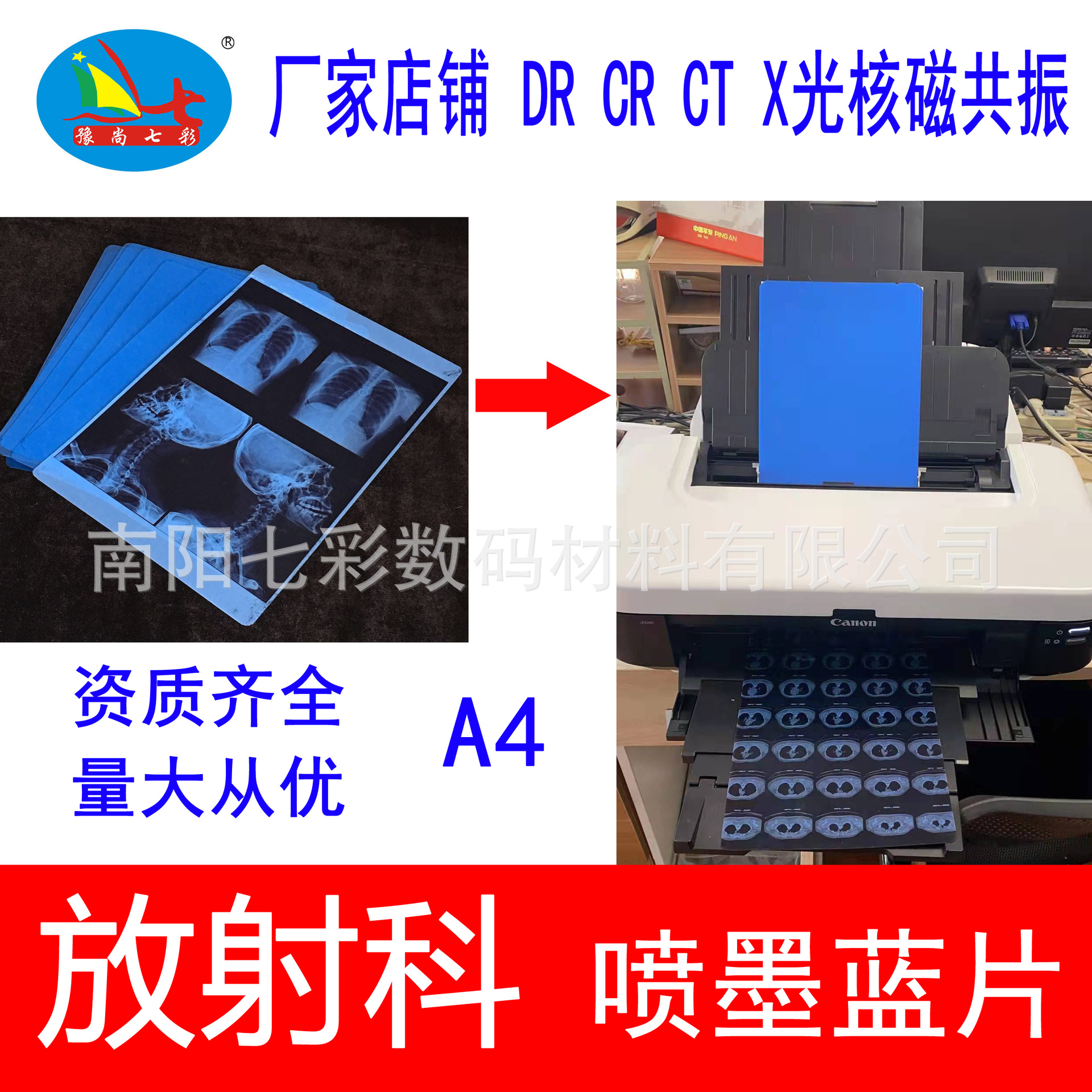 厂家批发A4医用蓝基喷墨打印胶片 蓝色喷墨放射科骨科pet打印胶片
