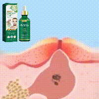 Jayswing Tea Tree Oil Lightens Marks, Moisturizes Repairs Facial Sensitivity, Reddening and Acne Removing essence_voghion.com