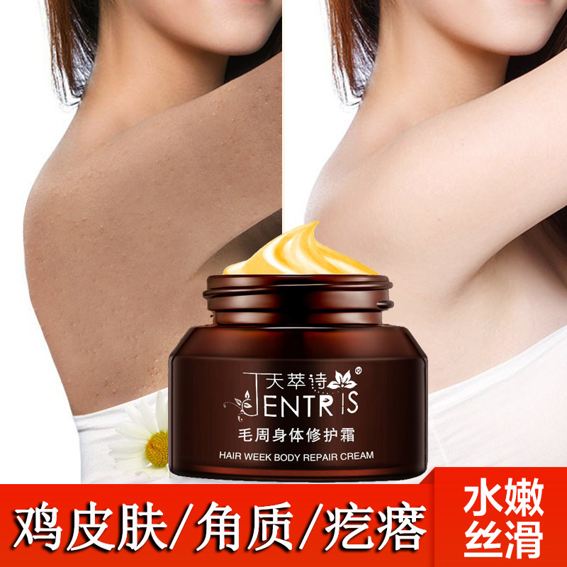 天萃诗毛周身体修护霜去全身鸡皮肤角质疙瘩毛囊角化蛇皮肤|ru