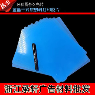 �t�Ç�ī�{ɫ�zƬ�{����ʽ����ƴ�ӡ�zƬ���ƹ���X��Ƭ DR CR CT