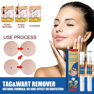 Eelhoe Skin Kelou Pen Mild Ingredients Body Skin Tag Removal Liquid Cleansing Skin Skin Care Pen
