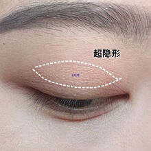 �������޺۳���Ȼ˫��Ƥ����������˫����Ƥ�Ŵ�����Ŀ��
