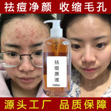 eѩAҺӡ]ڷ۴ഺŮë׼ԭҺ