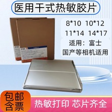 ���l ����t�ø�ʽ�����zƬCT DR�Ź��� �m�ø�ʿ����ۿ˰l���C