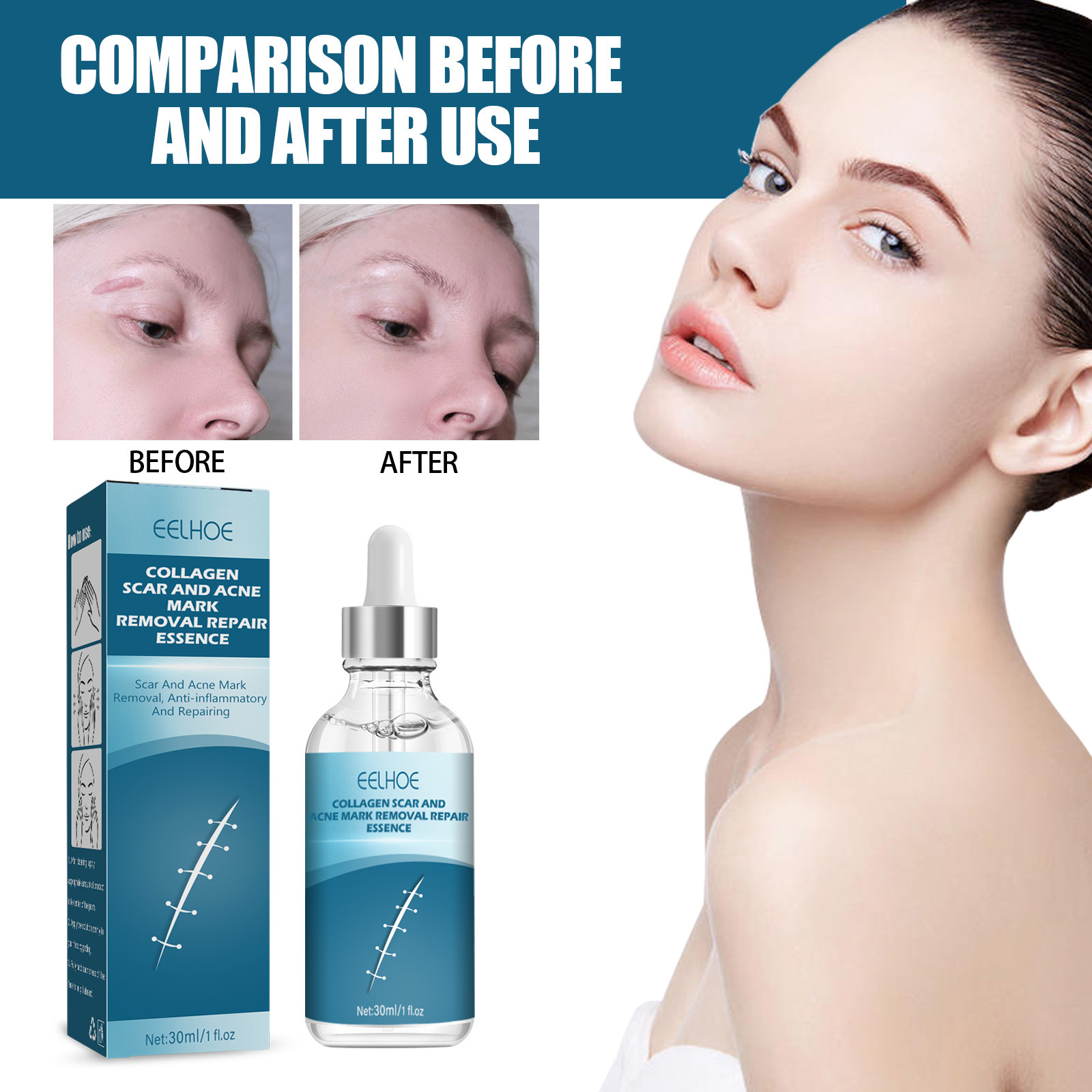 EELHOE Essence de réparation de cicatrices, estompe les cicatrices chirurgicales, essence de réparation de cicatrice de césarienne, lisse et hydrate la peau, (paquet de 3)_voghion.com