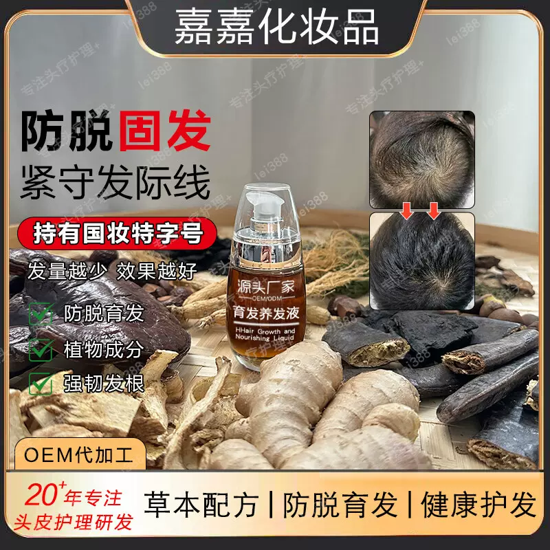 OEM天然植物防脱育发液养发防脱发固发滋养头发防脱精华育发液ODM