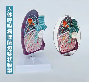 Pathological lung model pathological lung anatomy smokers visceral pathological lung section respiratory system model