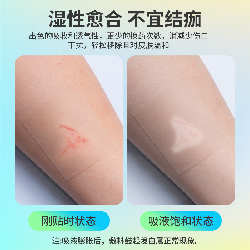 跨境爆款Hydrocolloid 水胶体敷料 伤口护理湿性愈合水胶体卷材贴|undefined