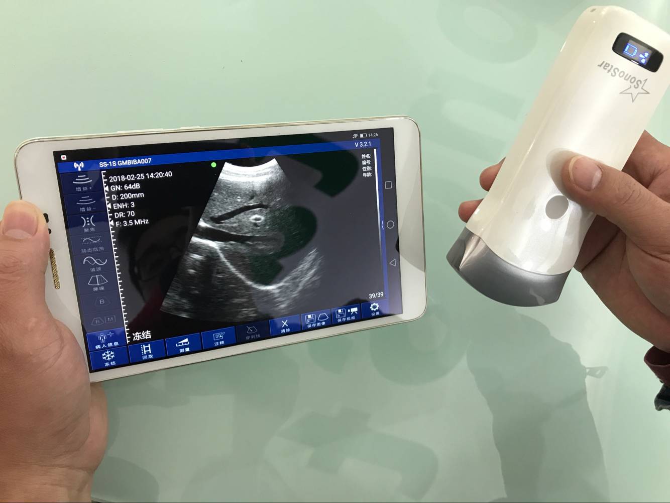 a0b42a8ffff88055366487b733e886