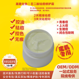 �ɶ�������o˪ȥ�ഺ��������ӡ���۸��ƶ����wɫȥ�]�ڷ۴�