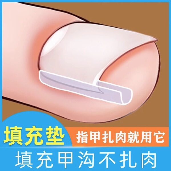 Orthotics for contouring for nails
