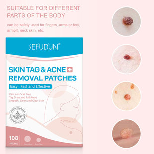 SEFUDUN Warts Dispelling Sticks for Neck Warts, Face Warts, Meat Tickles, Small Pimples, Warts Dispelling Sticks 108 Sticks