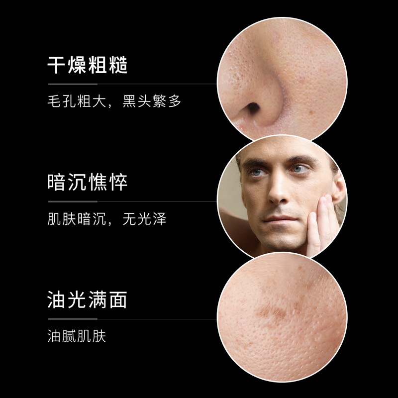 Kit de Cuidado de la Piel para Hombre Fanzhen: Limpieza, Hidratación, Refrescante, Control de Grasa - Set de Cuidado de la Piel para Hombre al por Mayor image 4