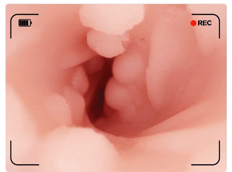 Manual Male Masturbator Cup with Dual Channel Soft Silicone Skin Tone — detail image 17