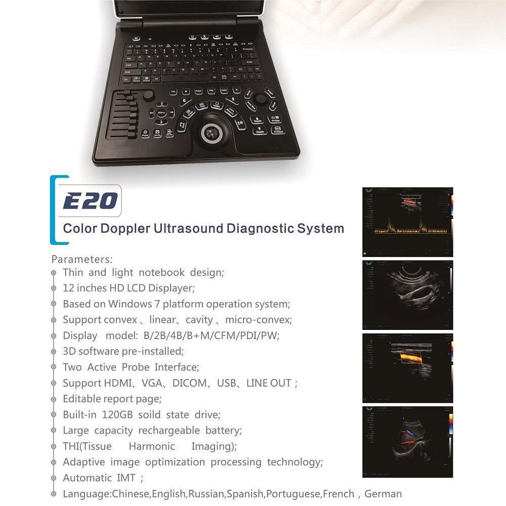 Hospital animal rancho portátil ultrasonido diagnóstico de lenguaje extranjero 12 pulgadas mascotas veterinarias fabricantes de ultrasonido de color