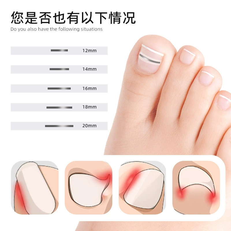 Armor patch Armor groove Armor coil Armor pull Armor patch toenails long flesh Armor pull Armor orthopedic device