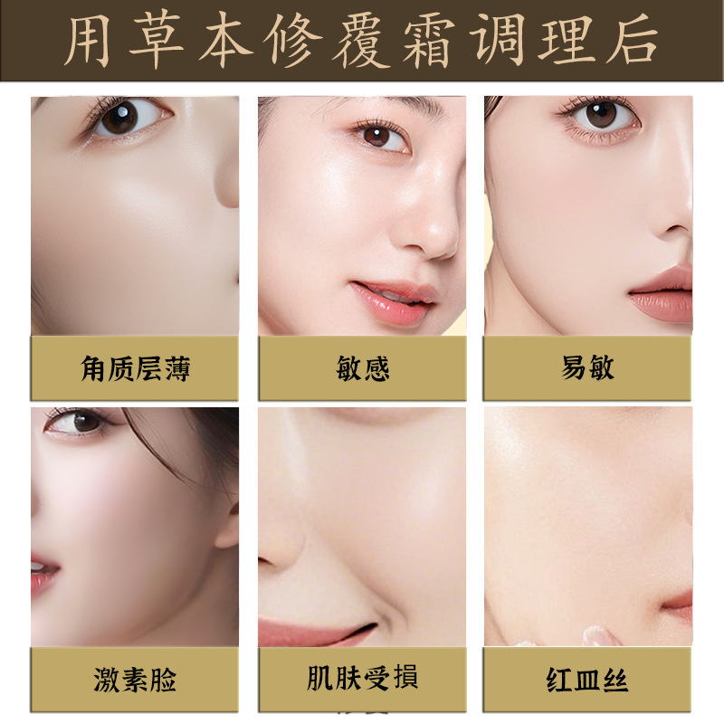 术后修复霜抗炎敏感肌增厚退红补水保湿敏感院线退红面霜舒缓肌肤|undefined