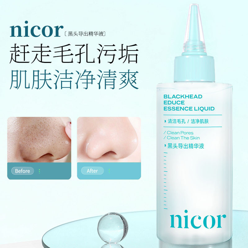 ニコール ブラックヘッド エクスポート エッセンス 150ml 毛穴をきれいにし、肌をきれいにし、毛穴をきれいにし、さわやかにします。|undefined