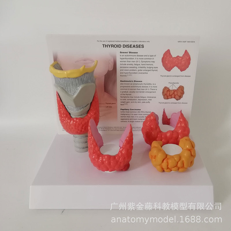 Human Thyroid Lesion Model, Highly Simulated Teaching Props, Dedicated for Anatomy Display in Medical Schools Human Thyroid Lesion Model, Highly Simulated Teaching Props, Dedicated for Anatomy Display in Medical Schools