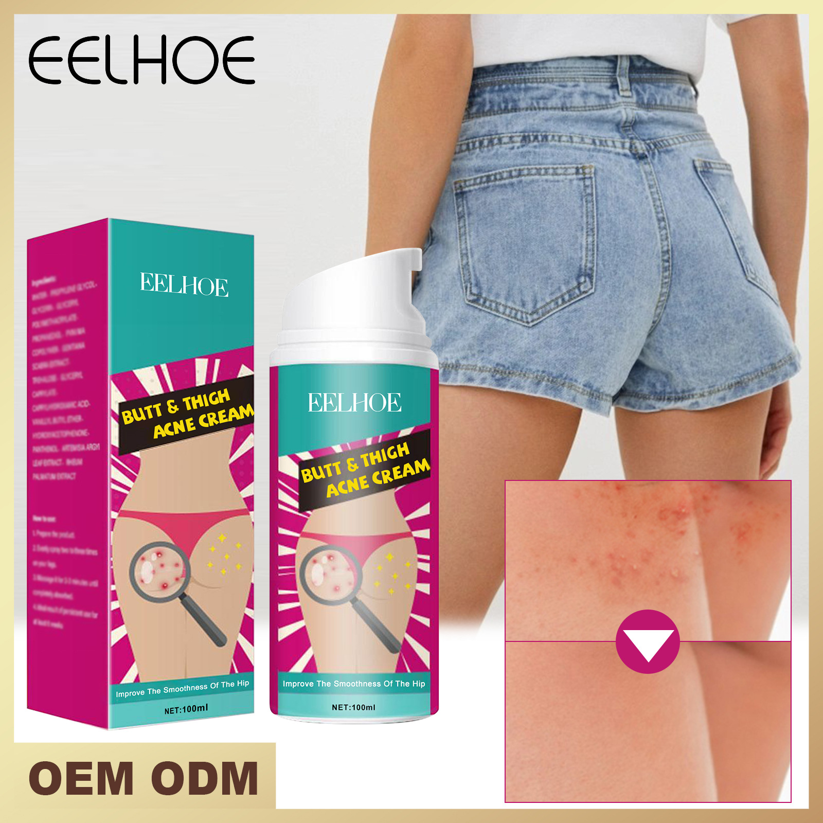 Hip and Beautiful Oberschenkel-Akne-Creme lindert Akne am Rücken, an den Hüften und an den Oberschenkeln und reinigt die Haut._voghion.com